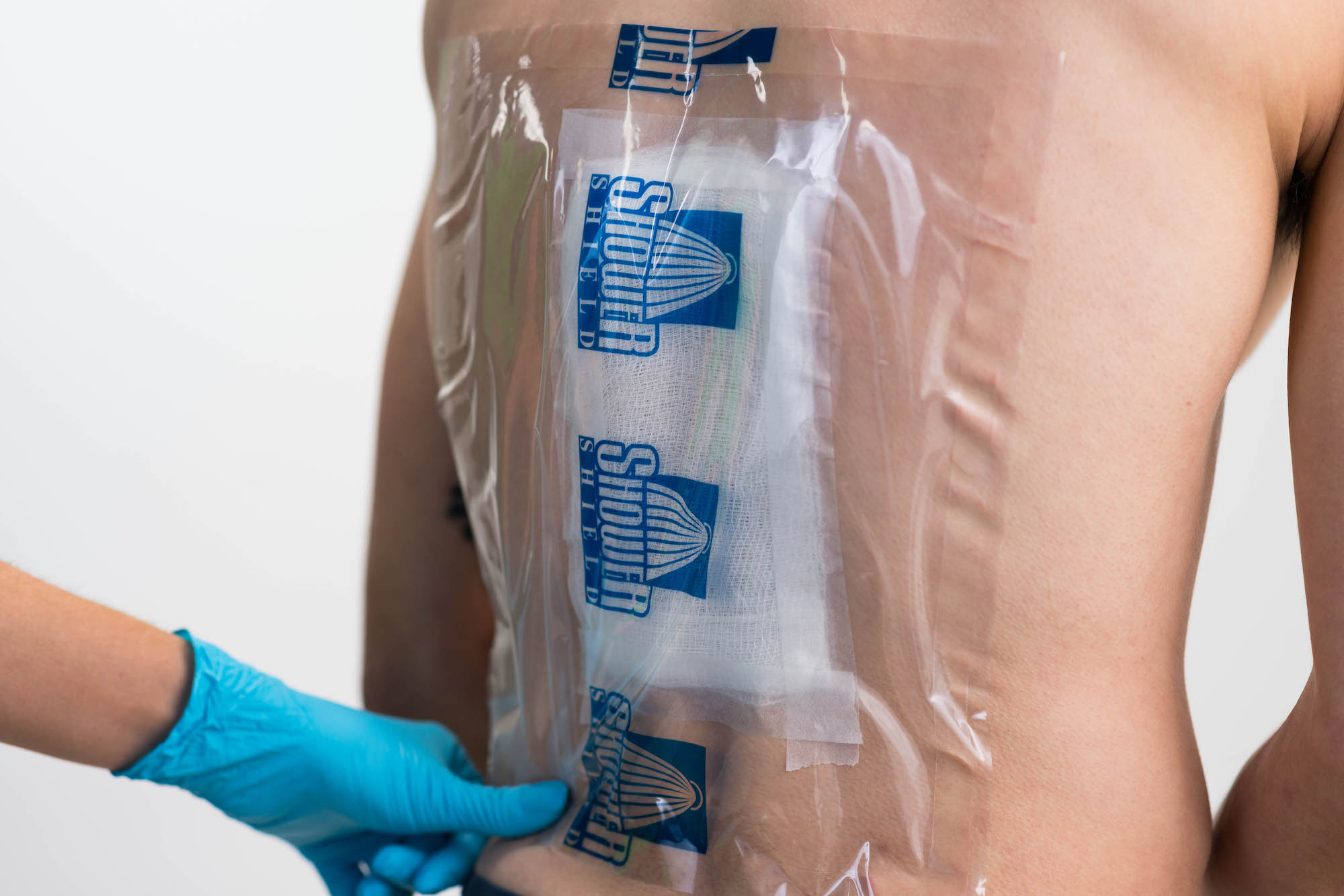 10X12 Wound & Catheter Cover